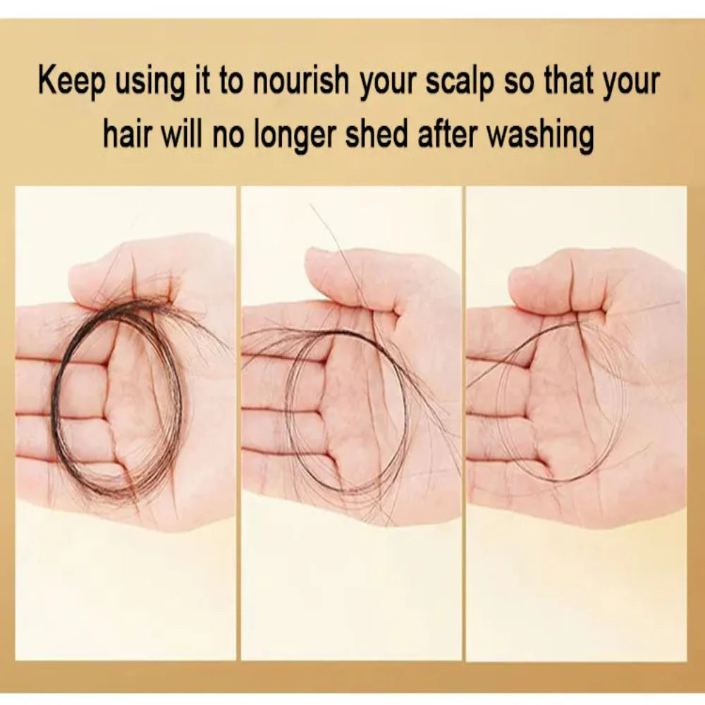 King Of Ginger Anti-Hair Loss Shampoo ( BUY 1 GET 1 FREE )