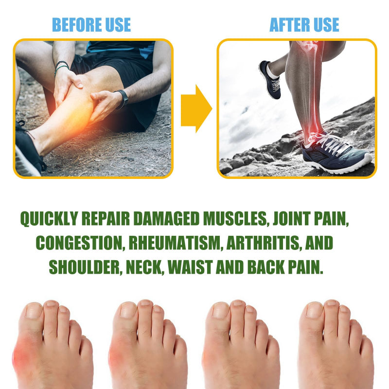 ✨ South Moon Tiger Oil Pain Relief Spray ✨ ( BUY 1 GET 1 FREE )