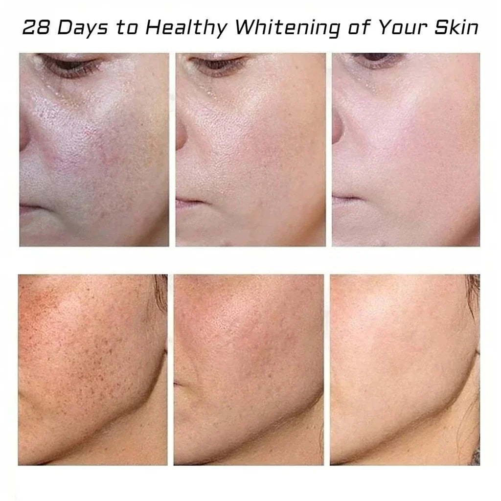 🌺🌙 GlowFade Radiance Repair Cream – Freckle, Pigmentation & Acne Scar Solution 🌸💧